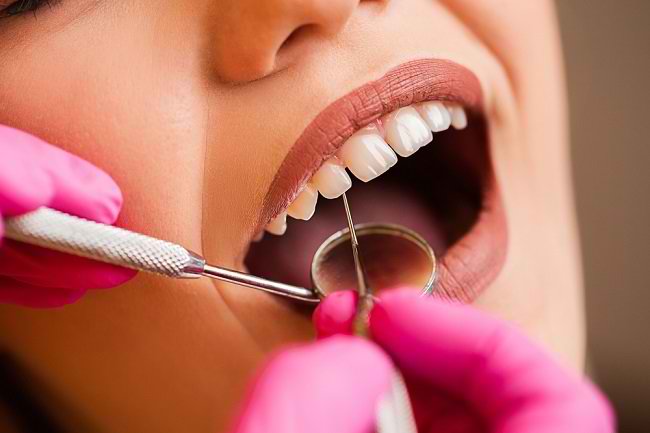 kenali cara menghilangkan karang gigi dengan scale 1 - Kenali Cara Menghilangkan Karang Gigi dengan Scaling